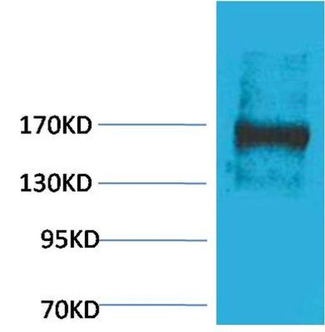 EPG5 Antibody in Western Blot (WB)