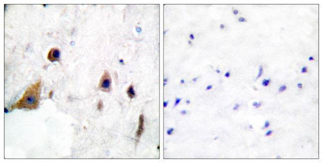 Phospho-DARPP-32 (Thr75) Antibody in Immunohistochemistry (Paraffin) (IHC (P))