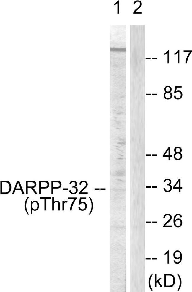 Phospho-DARPP-32 (Thr75) Antibody in Western Blot (WB)