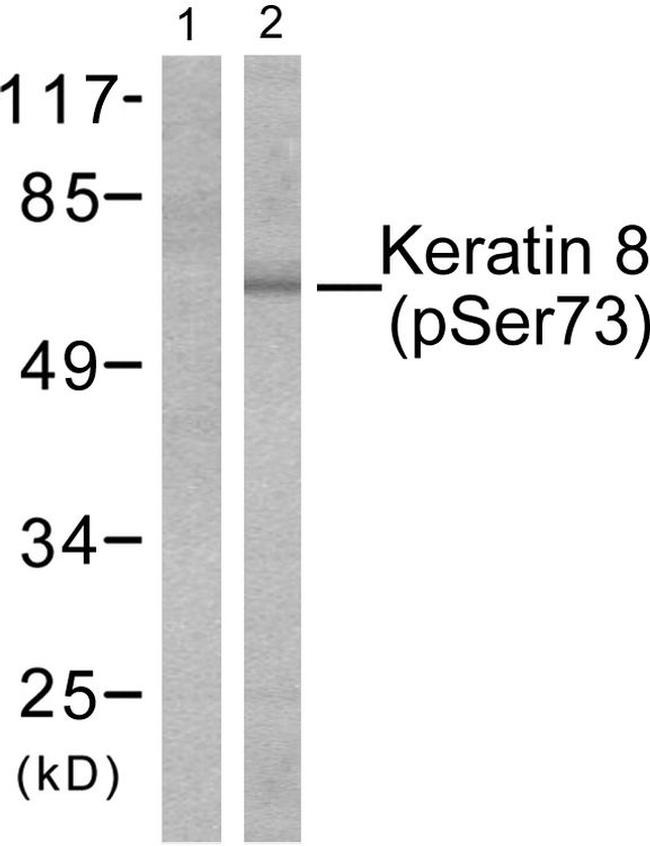 Phospho-Cytokeratin 8 (Ser73) Antibody in Western Blot (WB)