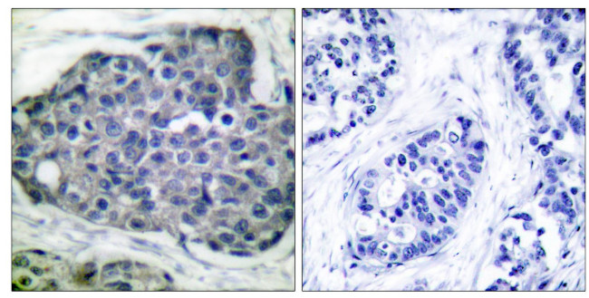 Phospho-Acetyl-CoA Carboxylase (Ser80) Antibody in Immunohistochemistry (Paraffin) (IHC (P))