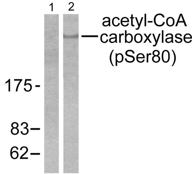 Phospho-Acetyl-CoA Carboxylase (Ser80) Antibody in Western Blot (WB)