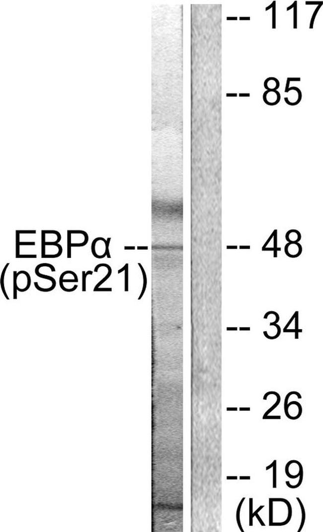 Phospho-C/EBP alpha (Ser21) Antibody in Western Blot (WB)