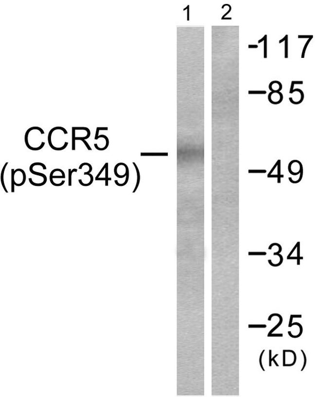 Phospho-CCR5 (Ser349) Antibody in Western Blot (WB)