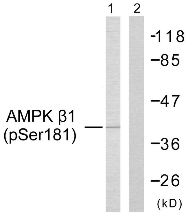 Phospho-AMPK beta-1 (Ser181) Antibody in Western Blot (WB)