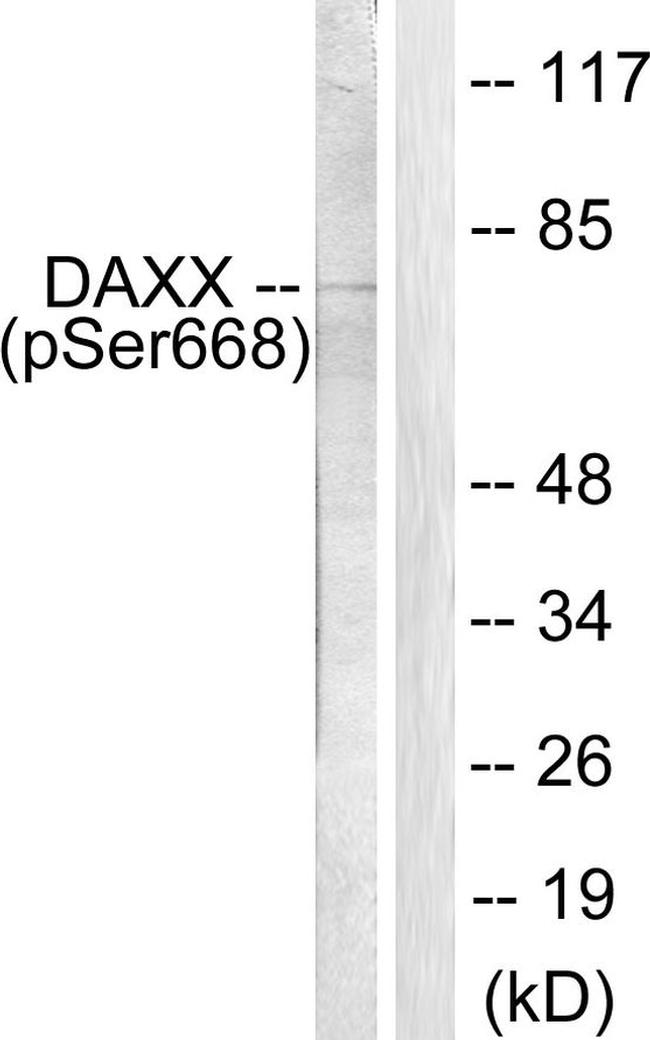 Phospho-DAXX (Ser668) Antibody in Western Blot (WB)