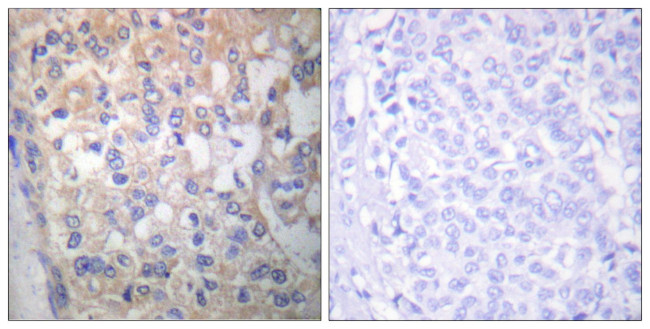 Phospho-Fyn (Tyr530) Antibody in Immunohistochemistry (Paraffin) (IHC (P))