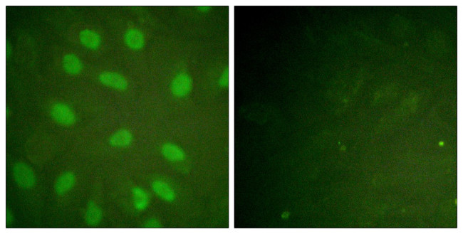 Phospho-Ku80 (Thr714) Antibody in Immunocytochemistry (ICC/IF)