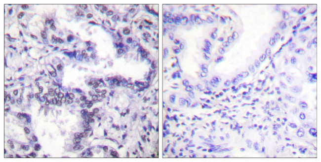 Phospho-Ku80 (Thr714) Antibody in Immunohistochemistry (Paraffin) (IHC (P))