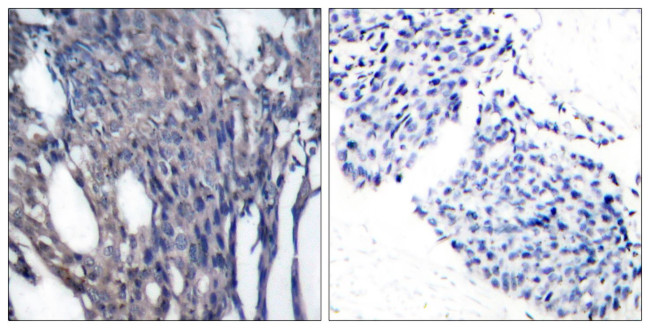 Phospho-IkB alpha (Tyr42) Antibody in Immunohistochemistry (Paraffin) (IHC (P))