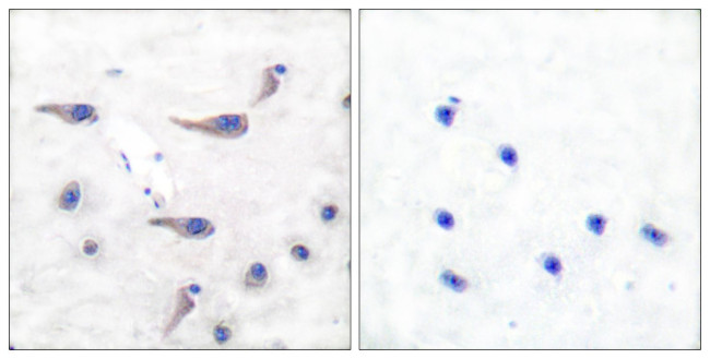 Phospho-MARCKS (Ser163) Antibody in Immunohistochemistry (Paraffin) (IHC (P))