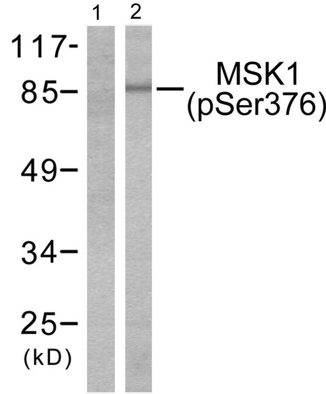 Phospho-MSK1 (Ser376) Antibody in Western Blot (WB)