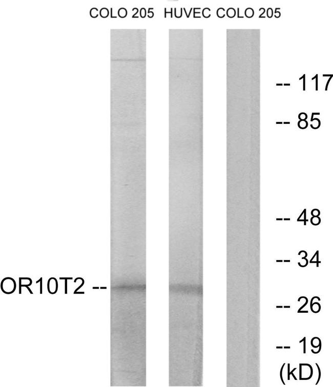 OR10T2 Antibody in Western Blot (WB)