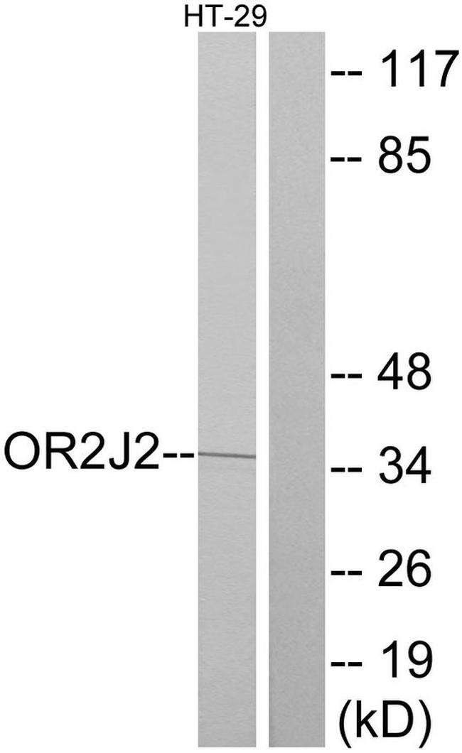 OR2J2 Antibody in Western Blot (WB)