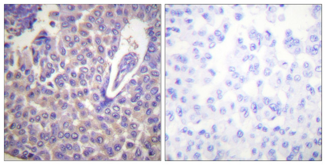 Phospho-Calnexin (Ser583) Antibody in Immunohistochemistry (Paraffin) (IHC (P))