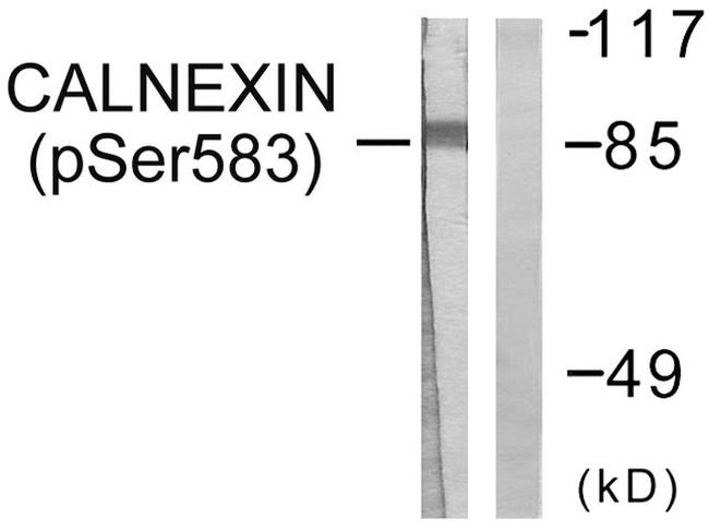 Phospho-Calnexin (Ser583) Antibody in Western Blot (WB)