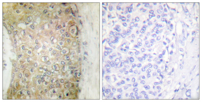 HSP20 Antibody in Immunohistochemistry (Paraffin) (IHC (P))