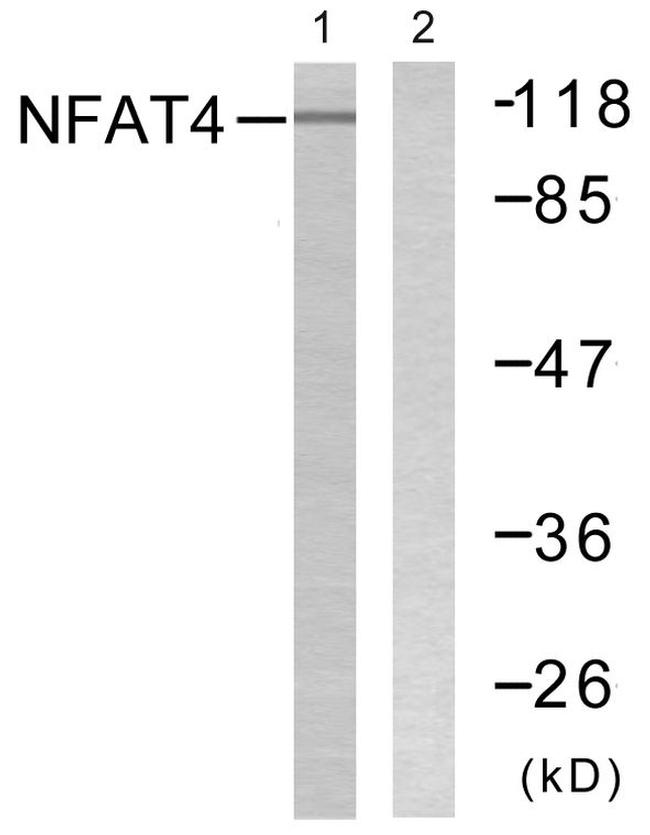 NFATC3 Antibody in Western Blot (WB)