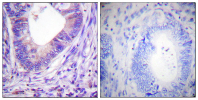 PKA alpha/beta Antibody in Immunohistochemistry (Paraffin) (IHC (P))