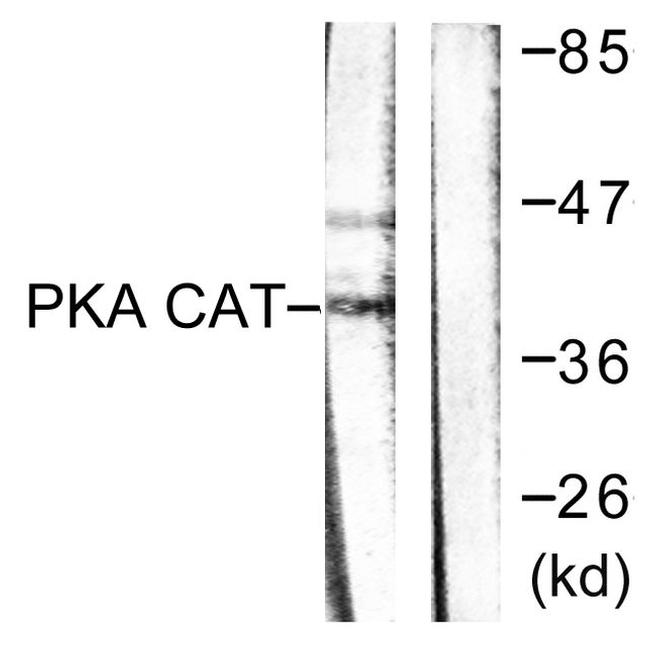 PKA alpha/beta Antibody in Western Blot (WB)