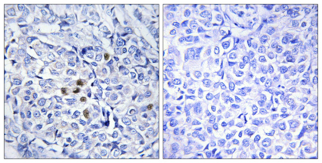 Phospho-PLK1 (Thr210) Antibody in Immunohistochemistry (Paraffin) (IHC (P))