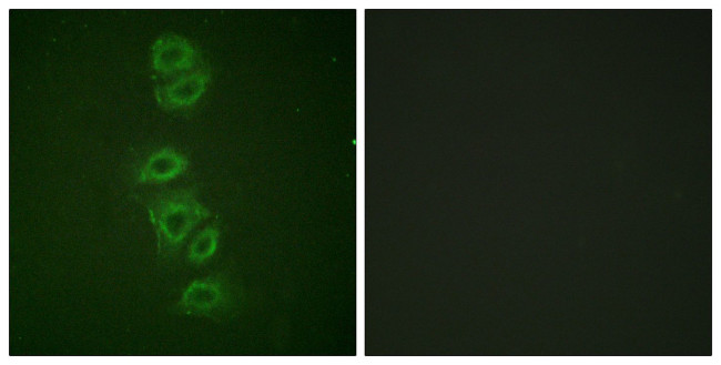 Phospho-PP2A alpha (Tyr307) Antibody in Immunocytochemistry (ICC/IF)