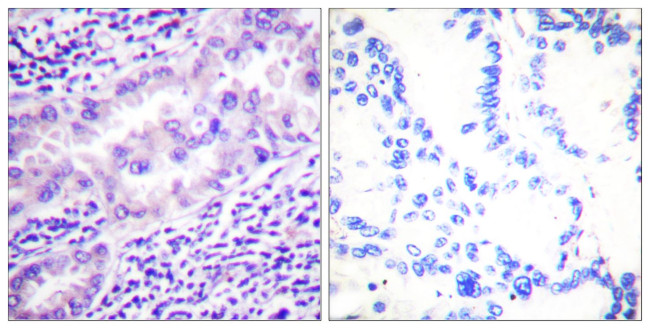 Phospho-PP2A alpha (Tyr307) Antibody in Immunohistochemistry (Paraffin) (IHC (P))