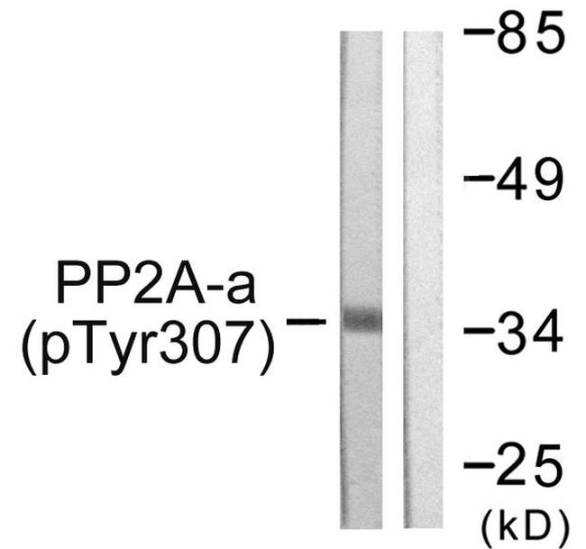 Phospho-PP2A alpha (Tyr307) Antibody in Western Blot (WB)