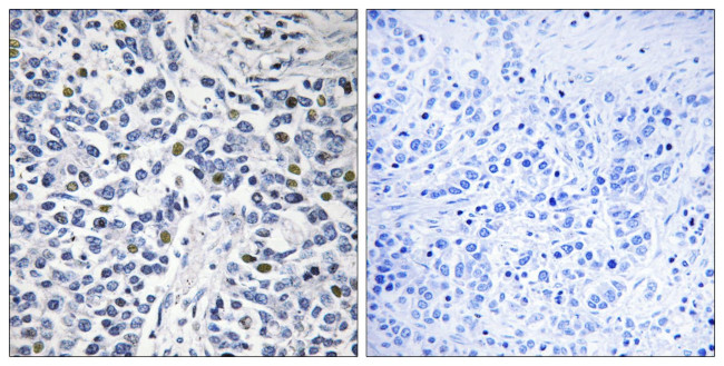 RAD9 Antibody in Immunohistochemistry (Paraffin) (IHC (P))