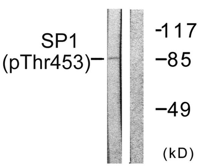 Phospho-SP1 (Thr453) Antibody in Western Blot (WB)