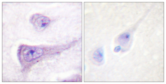 Phospho-WASP (Tyr290) Antibody in Immunohistochemistry (Paraffin) (IHC (P))