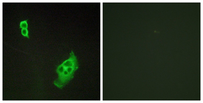 WAVE1 Antibody in Immunocytochemistry (ICC/IF)