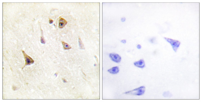 WAVE1 Antibody in Immunohistochemistry (Paraffin) (IHC (P))