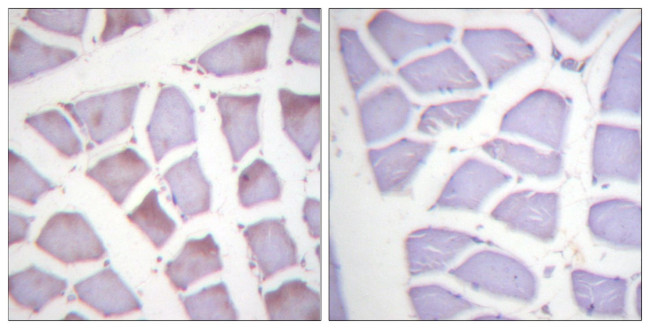 Phospho-XIAP (Ser87) Antibody in Immunohistochemistry (Paraffin) (IHC (P))