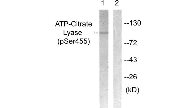 Phospho-ATP Citrate Lyase (Ser455) Antibody in Western Blot (WB)