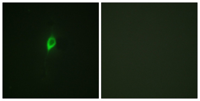 Phospho-eIF4B (Ser422) Antibody in Immunocytochemistry (ICC/IF)