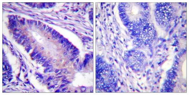 Phospho-eIF4B (Ser422) Antibody in Immunohistochemistry (Paraffin) (IHC (P))