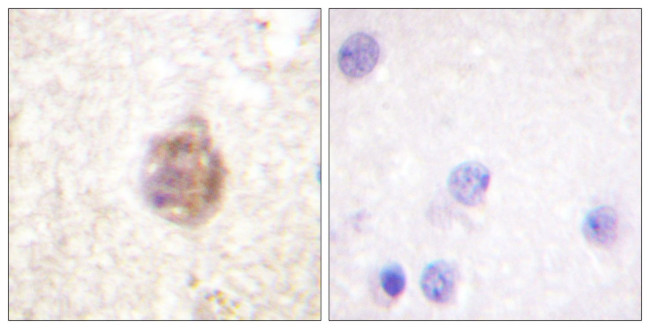 Phospho-IRS1 (Ser794) Antibody in Immunohistochemistry (Paraffin) (IHC (P))