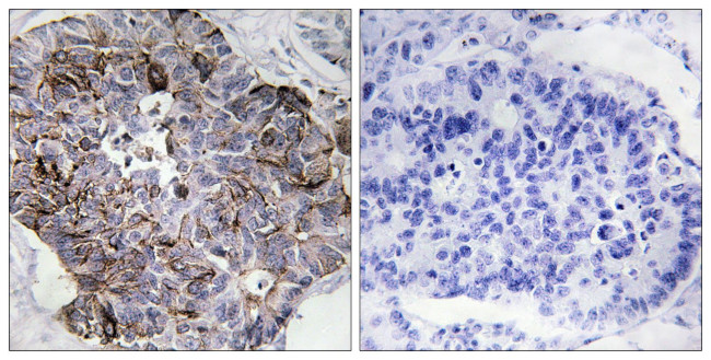 MRLC2 Antibody in Immunohistochemistry (Paraffin) (IHC (P))