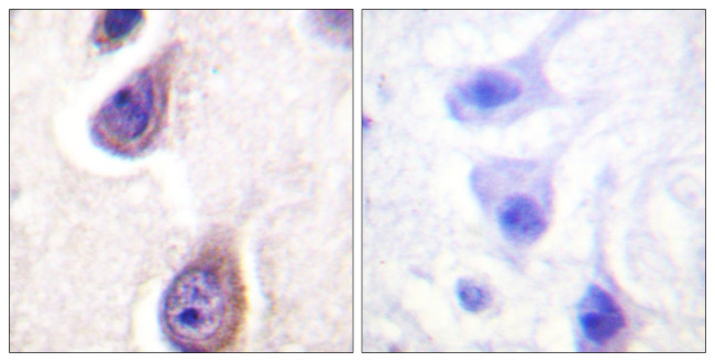 Phospho-PLD1 (Ser561) Antibody in Immunohistochemistry (Paraffin) (IHC (P))