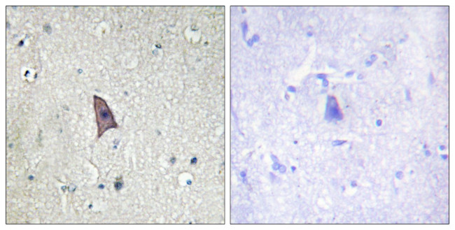 Phospho-TEK (Tyr1102) Antibody in Immunohistochemistry (Paraffin) (IHC (P))