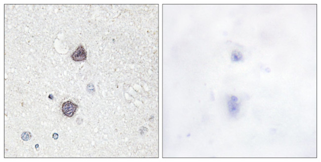 Phospho-Aquaporin 2 (Ser256) Antibody in Immunohistochemistry (Paraffin) (IHC (P))