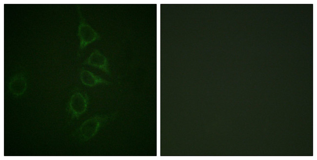 Phospho-Calmodulin (Thr79, Ser81) Antibody in Immunocytochemistry (ICC/IF)