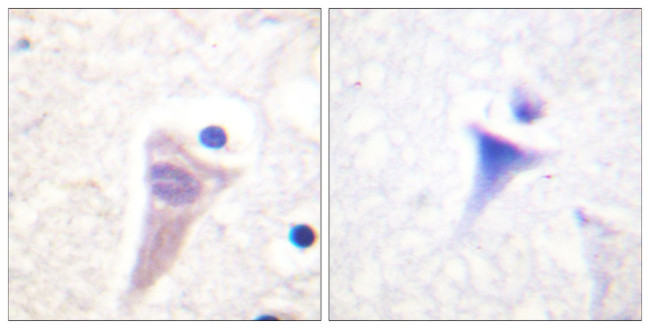 Phospho-Calmodulin (Thr79, Ser81) Antibody in Immunohistochemistry (Paraffin) (IHC (P))