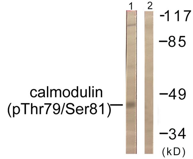 Phospho-Calmodulin (Thr79, Ser81) Antibody in Western Blot (WB)