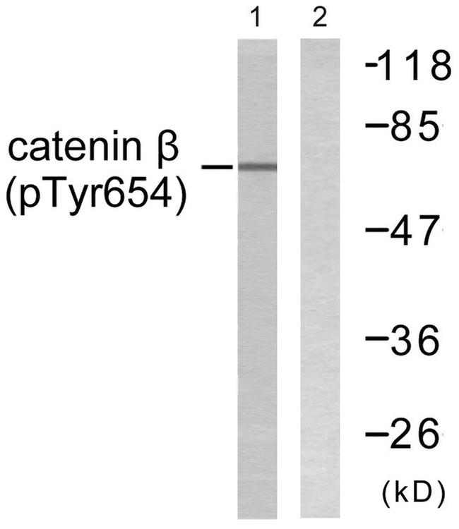 Phospho-beta Catenin (Tyr654) Antibody in Western Blot (WB)