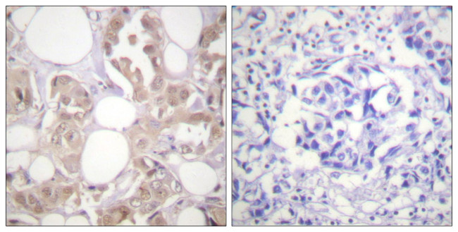 Phospho-CDK7 (Thr170) Antibody in Immunohistochemistry (Paraffin) (IHC (P))