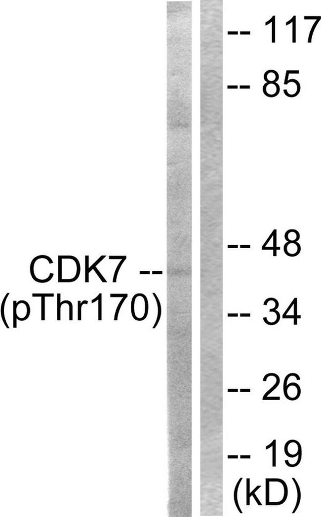 Phospho-CDK7 (Thr170) Antibody in Western Blot (WB)