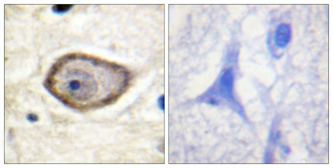 Phospho-CD142 (Ser290) Antibody in Immunohistochemistry (Paraffin) (IHC (P))