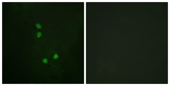 Phospho-Cyclin E2 (Thr392) Antibody in Immunocytochemistry (ICC/IF)